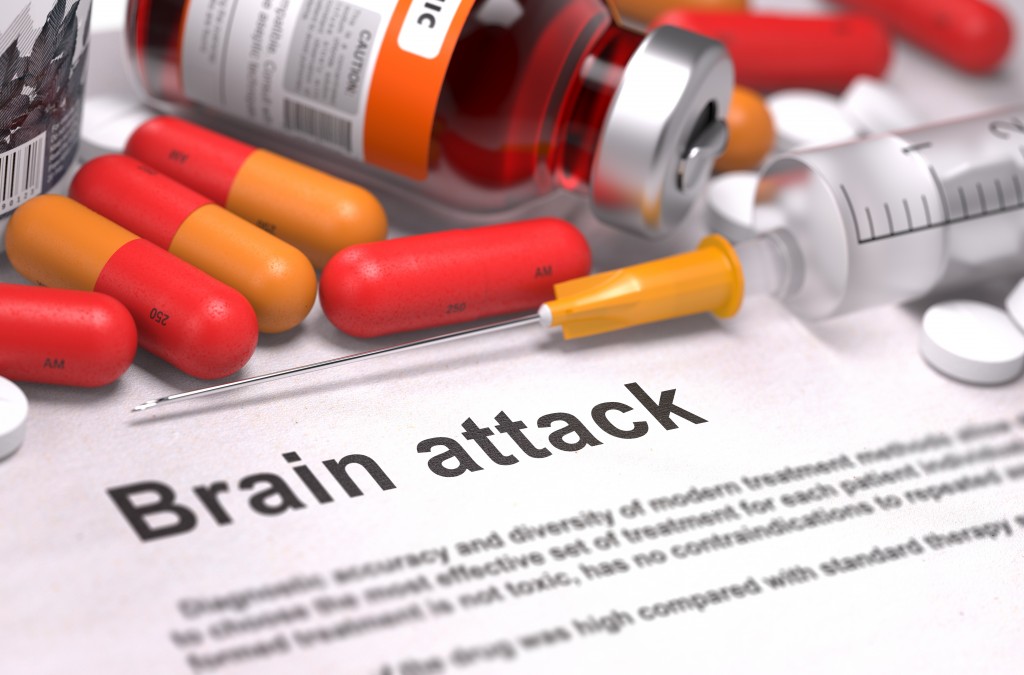 brain-attack-stroke-cva